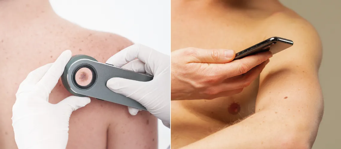 campana-cancer-pielpng